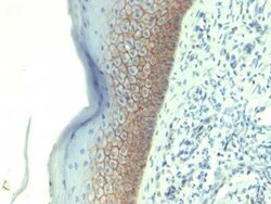 E-Cadherin Antibody (CDH1/1525), Novus Biologicals:Antibodies:Primary Antibodies