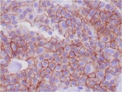 E-Cadherin Antibody (CDH1/1525), Novus Biologicals:Antibodies:Primary Antibodies