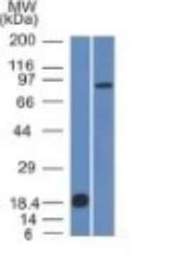 E-Cadherin Antibody (CDH1/1525), Novus Biologicals:Antibodies:Primary Antibodies