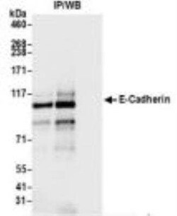 E-Cadherin Antibody (BLR088G), Novus Biologicals 100 &mu;g | Buy Online | Bio-Techne | Fisher Scientific