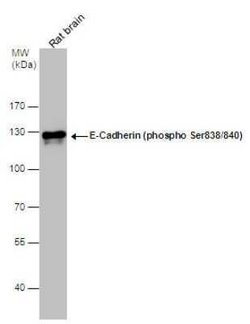E-Cadherin, p Ser838, p Ser840 Antibody, Novus Biologicals 100 &mu;g | Buy Online | Novus Biologicals | Fisher Scientific
