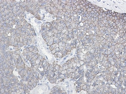 E-Cadherin, p Ser838, p Ser840 Antibody (S03-3B3), Novus Biologicals 100