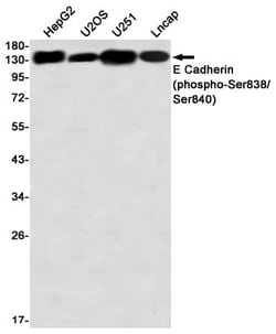 E-Cadherin, p Ser838, p Ser840 Antibody (S03-3B3), Novus Biologicals 100