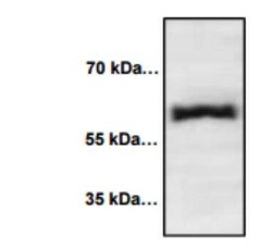 E-Selectin/CD62E Antibody, Novus Biologicals 50 &mu;g; Unconjugated:Antibodies,