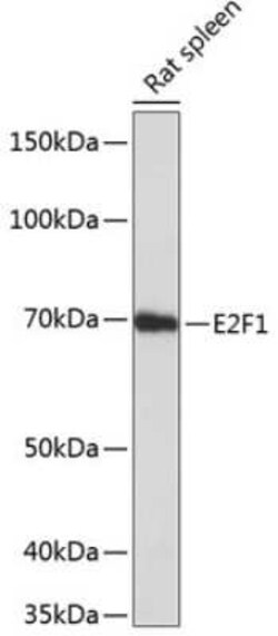 E2F-1 Rabbit anti-Human, Mouse, Rat, Clone: 5Z5U3, Novus Biologicals 20 &mu;g | Buy Online | Novus Biologicals | Fisher Scientific