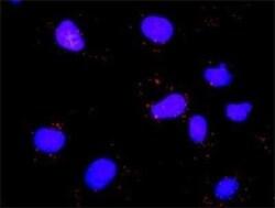 E2F-1 Antibody (2E10), Novus Biologicals 0.1 mg | Buy Online | Novus Biologicals | Fisher Scientific