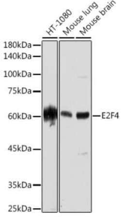 E2F-4 Rabbit anti-Human, Mouse, Clone: 3O6Y9, Novus Biologicals 20 &mu;g | Buy Online | Bio-Techne | Fisher Scientific