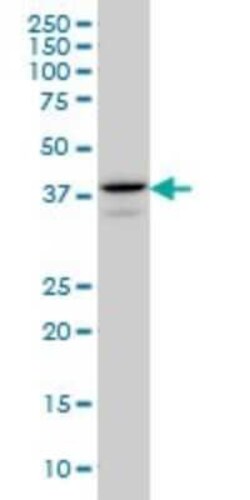 E2F-4 Antibody (5B7), Novus Biologicals 0.1 mg | Buy Online | Novus Biologicals | Fisher Scientific