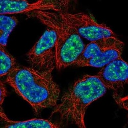 E2F3 Antibody, Novus Biologicals 25ul; Unconjugated:Antibodies, Polyclonal