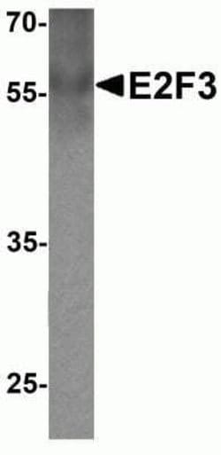 E2F3 Antibody - BSA Free, Novus Biologicals 0.1 mg | Buy Online | Novus Biologicals | Fisher Scientific