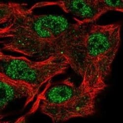 E2F5 Rabbit anti-Human, Polyclonal, Novus Biologicals:Antibodies:Primary