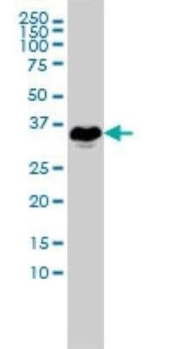 E2F6 Antibody (1F7-A9), Novus Biologicals 0.1 mg | Buy Online | Novus Biologicals | Fisher Scientific