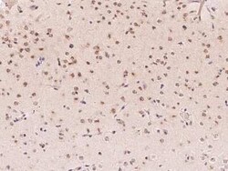 E2F6 Antibody, Novus Biologicals 100 &mu;g; Unconjugated:Antibodies, Polyclonal