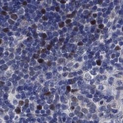 E2F8 Rabbit anti-Human, Polyclonal, Novus Biologicals 25 &mu;g; Unconjugated:Antibodies,
