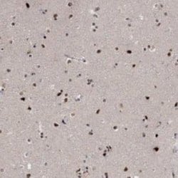 E4F1 Rabbit anti-Human, Polyclonal, Novus Biologicals 100 &mu;g | Buy Online | Novus Biologicals | Fisher Scientific