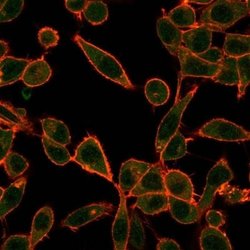 E6AP/UBE3A Mouse anti-Human, Clone: PCRP-UBE3A-1A2, Novus Biologicals:Antibodies:Primary