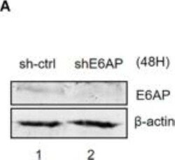 E6AP/UBE3A Antibody (2F6), Novus Biologicals 0.1 mg | Buy Online | Novus Biologicals | Fisher Scientific