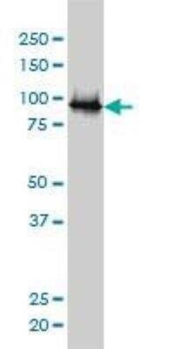 E6AP/UBE3A Antibody (2F6), Novus Biologicals 0.1 mg | Buy Online | Novus Biologicals | Fisher Scientific