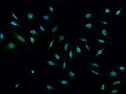 E6AP/UBE3A Antibody, Novus Biologicals 50 &mu;g; Unconjugated:Antibodies,