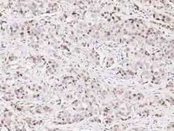E6AP/UBE3A Antibody, Novus Biologicals 100 &mu;g, Unconjugated:Antibodies,