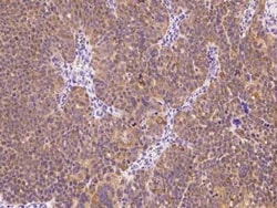E6AP/UBE3A Antibody, Novus Biologicals 50 &mu;g; Unconjugated:Antibodies,