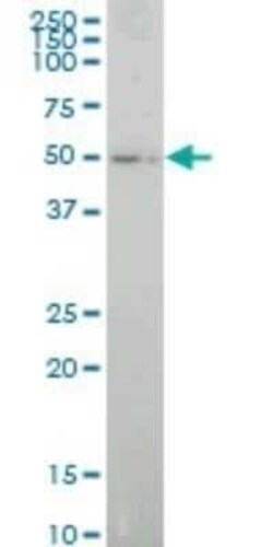E74 like factor 1 Antibody (3B7), Novus Biologicals 0.1 mg | Buy Online | Novus Biologicals | Fisher Scientific
