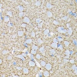 EAAT1/GLAST-1/SLC1A3 Rabbit anti-Human, Mouse, Rat, Clone: 7Y4U5, Novus