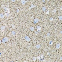 EAAT1/GLAST-1/SLC1A3 Rabbit anti-Human, Mouse, Rat, Clone: 7Y4U5, Novus