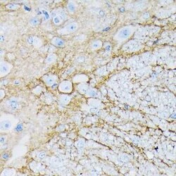 EAAT1/GLAST-1/SLC1A3 Rabbit anti-Human, Mouse, Rat, Clone: 7Y4U5, Novus
