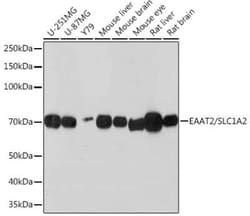 EAAT2/GLT1 Rabbit anti-Human, Mouse, Rat, Clone: 7K5F7, Novus Biologicals:Antibodies:Primary