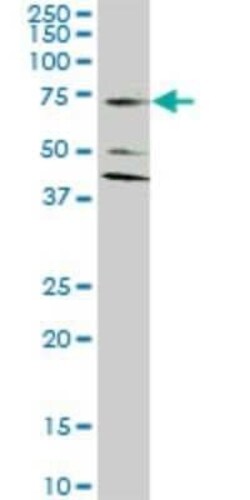 EAAT2/GLT1 Antibody (1D8), Novus Biologicals 0.1 mg | Buy Online | Novus Biologicals | Fisher Scientific