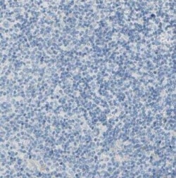 EAAT2/GLT1 Antibody, Novus Biologicals 0.1 mL | Buy Online | Novus Biologicals | Fisher Scientific