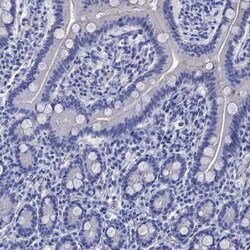 EAAT2/GLT1 Rabbit anti-Human, Polyclonal, Novus Biologicals:Antibodies:Primary