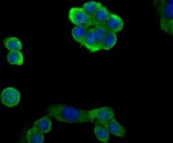 EAAT3 Rabbit anti-Human, Mouse, Rat, Clone: JU39-69, Novus Biologicals