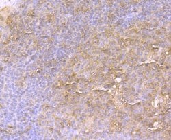 EAAT3 Rabbit anti-Human, Mouse, Rat, Clone: JU39-69, Novus Biologicals