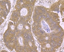 EAAT3 Rabbit anti-Human, Mouse, Rat, Clone: JU39-69, Novus Biologicals