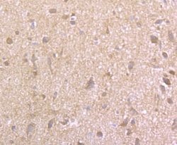 EAAT3 Rabbit anti-Human, Mouse, Rat, Clone: JU39-69, Novus Biologicals