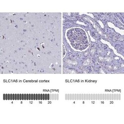 EAAT4 Antibody, Novus Biologicals 25 &mu;L, Unconjugated:Antibodies, Polyclonal