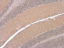 EAAT4 Antibody, Novus Biologicals 100 &mu;g | Buy Online | Novus Biologicals | Fisher Scientific