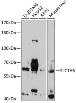 EAAT4 Antibody - BSA Free, Novus Biologicals 0.02 mL, Unconjugated:Antibodies,