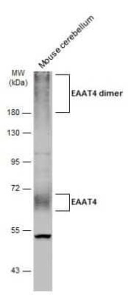 EAAT4 Antibody, Novus Biologicals 100 μg; Unconjugated:Antibodies, Polyclonal
