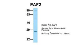 EAF2 Rabbit anti-Human, Polyclonal, Novus Biologicals 0.1 mL | Buy Online | Novus Biologicals | Fisher Scientific