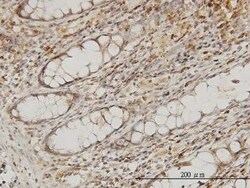 EB2 Antibody (4D7), Novus Biologicals 0.1 mg | Buy Online | Novus Biologicals | Fisher Scientific