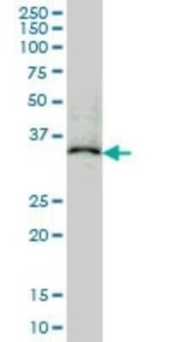 EB2 Antibody (4D7), Novus Biologicals 0.1 mg | Buy Online | Novus Biologicals | Fisher Scientific
