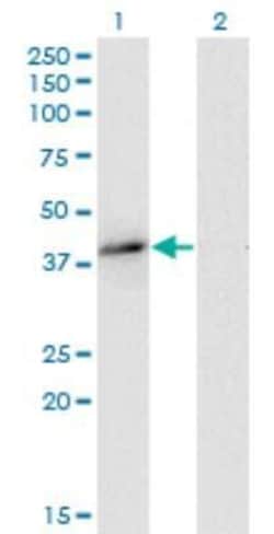 EB2 Antibody (4D7), Novus Biologicals 0.1 mg | Buy Online | Novus Biologicals | Fisher Scientific