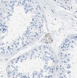 EB2 Antibody, Novus Biologicals 0.1 mL; Unconjugated:Antibodies, Polyclonal