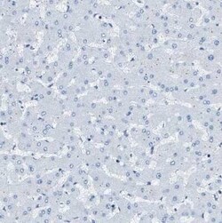 EB2 Antibody, Novus Biologicals 0.1 mL; Unconjugated:Antibodies, Polyclonal