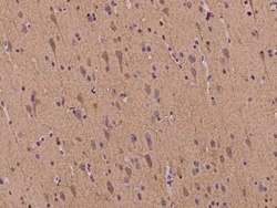 EB2 Antibody, Novus Biologicals:Antibodies:Primary Antibodies