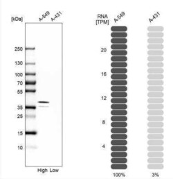 EB2 Antibody, Novus Biologicals 0.1 mL; Unconjugated:Antibodies, Polyclonal