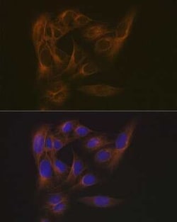 EB3 Rabbit anti-Human, Mouse, Rat, Clone: 7J9V3, Novus Biologicals 100 &mu;g | Buy Online | Novus Biologicals | Fisher Scientific
